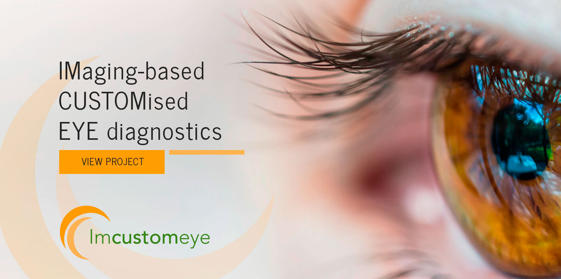 Imaging-based Customised Eye diagnostics (IMCUSTOMEYE)