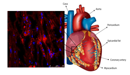 Lipoproteínas y salud cardiovascular